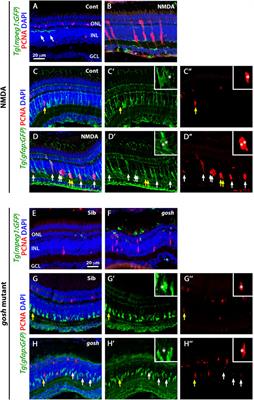 Different inflammation responses modulate Müller glia proliferation in the acute or chronically damaged zebrafish retina